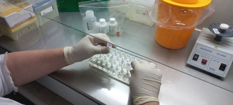 ПЦР-диагностика картофеля: какие болезни поразили семенной урожай в 2025 году